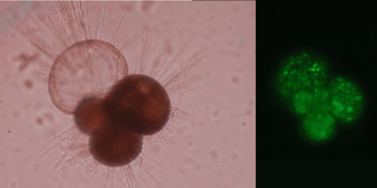 Microscopische foto's van foraminiferen