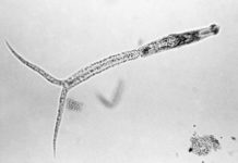 Kans op zwemmersjeuk na zwemmen in Bronsbergenmeer Larve van de platworm (cercaria) - Foto: Centers for Disease Control and Prevention