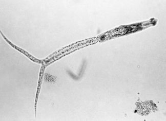 Kans op zwemmersjeuk na zwemmen in Bronsbergenmeer Larve van de platworm (cercaria) - Foto: Centers for Disease Control and Prevention